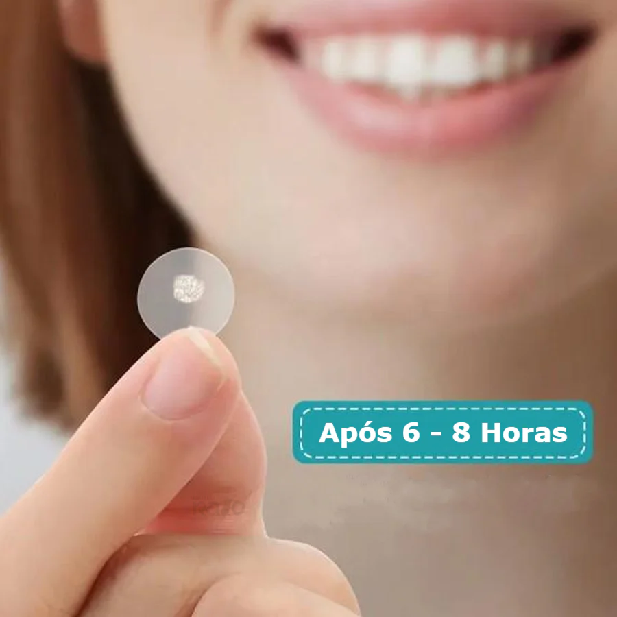 Adesivo para Acne - Pack 72 - Image 4