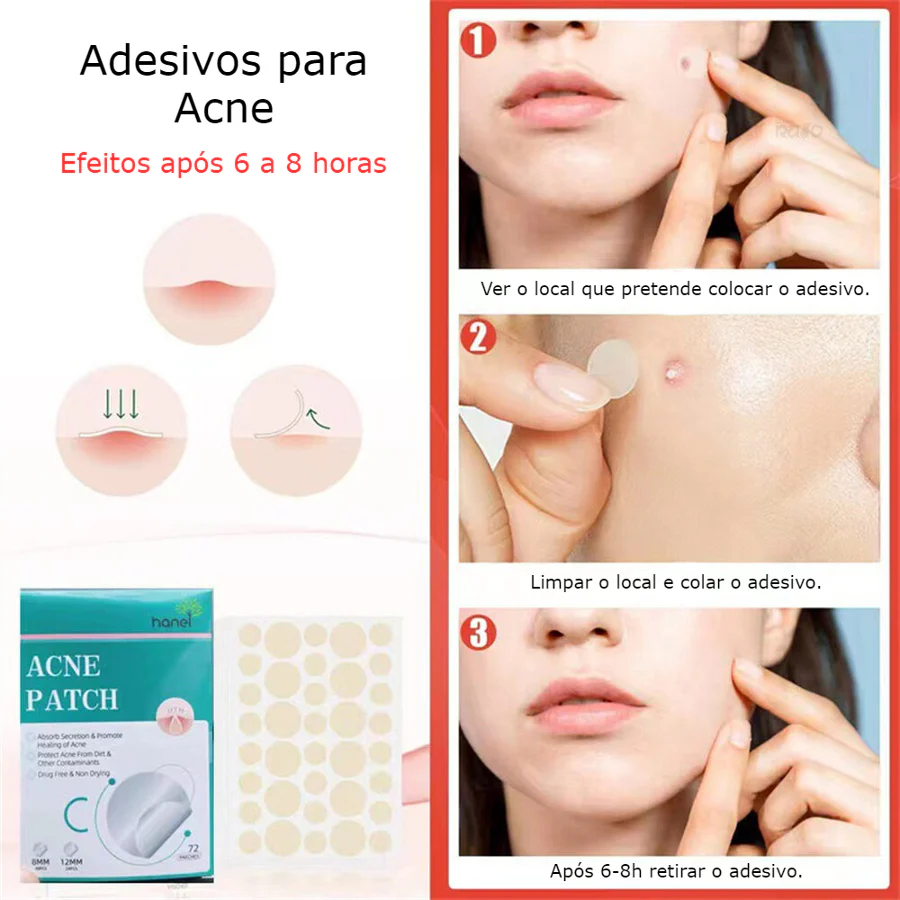Adesivo para Acne - Pack 72 - Image 6