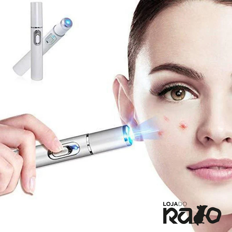 Caneta de Tratamento Laser- Acne, Manchas e Cicatrizes - Image 4