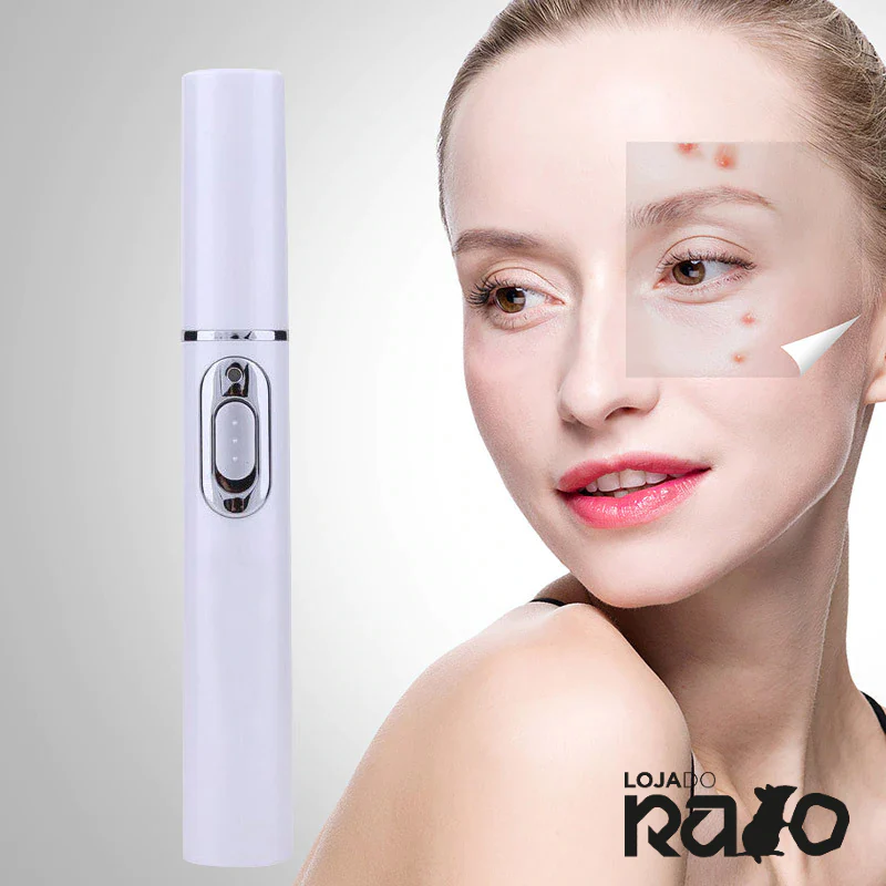 Caneta de Tratamento Laser- Acne, Manchas e Cicatrizes - Image 5