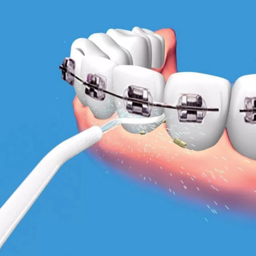 Irrigador Oral Dental Portátil - Power Floss - Image 3
