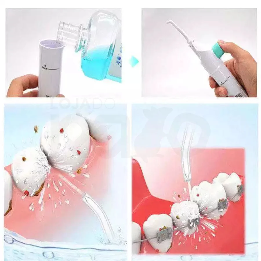 Irrigador Oral Dental Portátil - Power Floss - Image 7