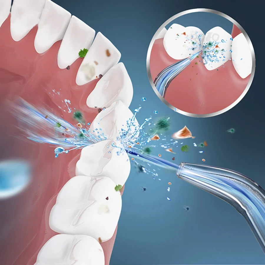 Irrigador Oral Elétrico Recarregável - Image 5