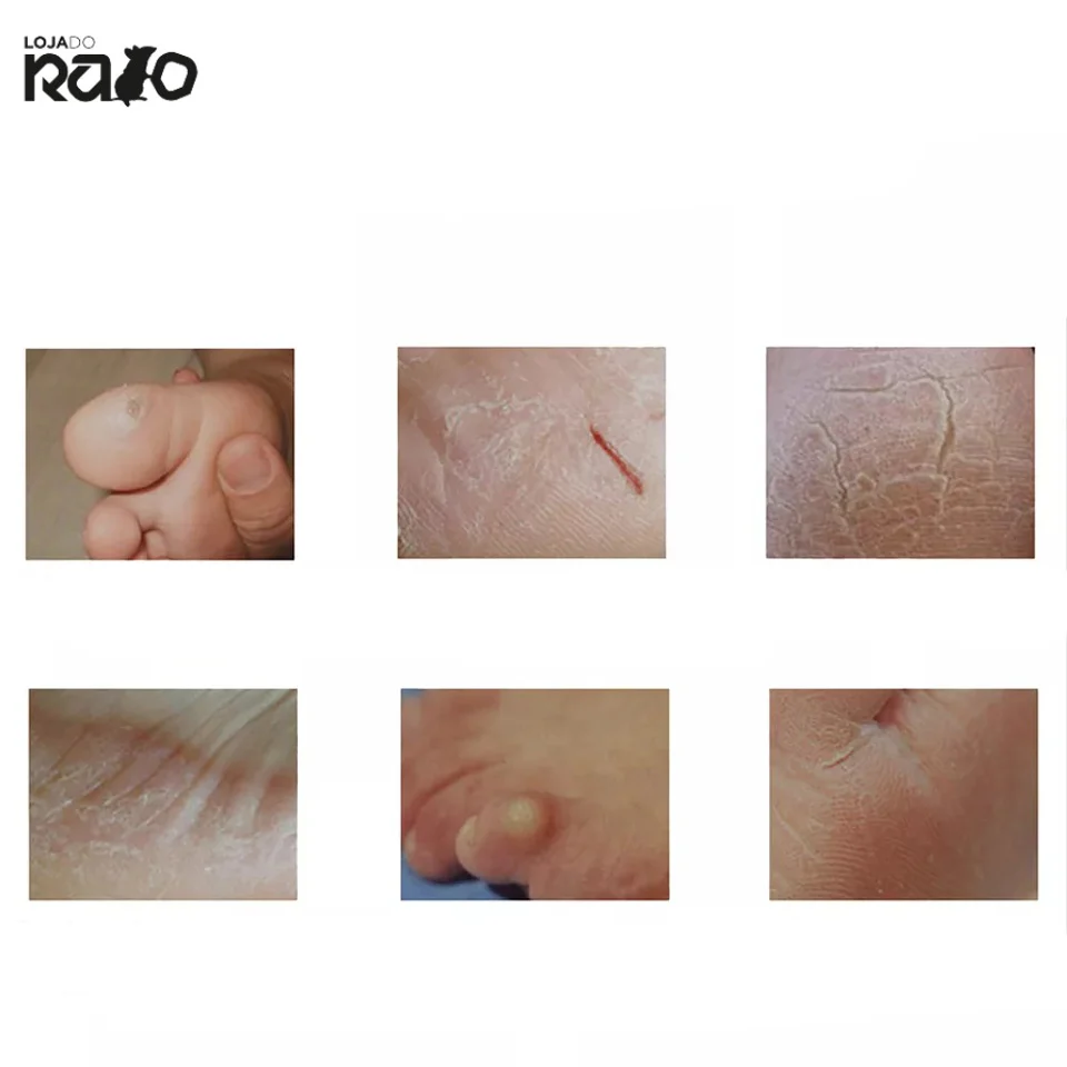 Lima Elétrica para Pedicure - Remove calosidades - Image 8