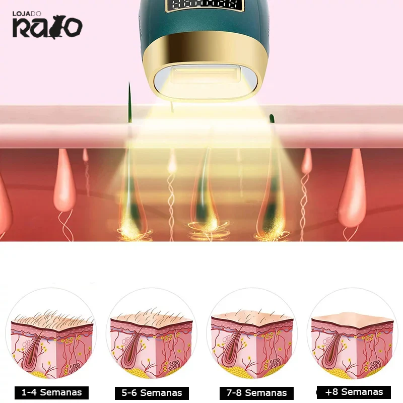 Máquina Depilação a Laser IPL - Doméstica - Image 6