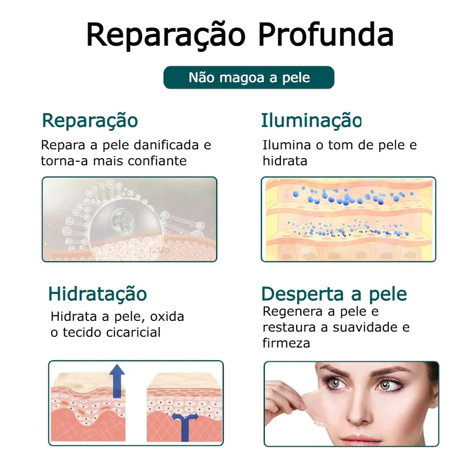 Rolo de Silicone para Cicatrizes - Image 4